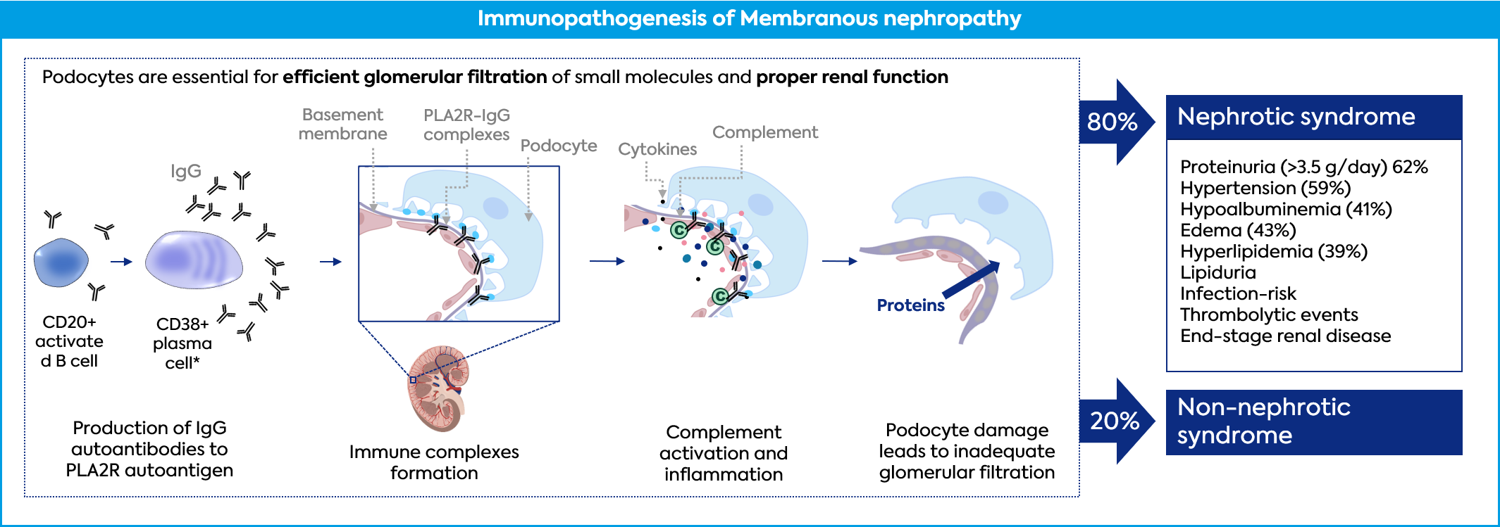 PATHOGENESIS IN ANTI-PLA2R ANTIBODY-POSITIVE MEMBRANOUS NEPHROPATHY